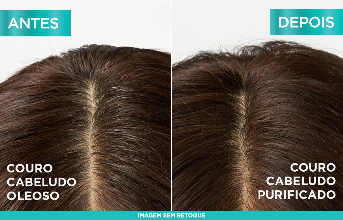 Saiba como tratar a oleosidade do cabelo | L'Oréal Paris